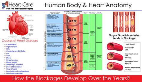 Chest pain. . Average artery blockage by age